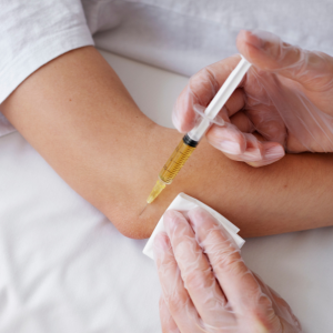 PRP Therapy