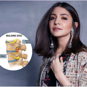 Suffering from Slip Disc Like Anushka Sharma
